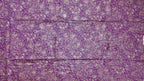 Mesmerizing Magenta: Artisan Embroidered Unstitched Suit